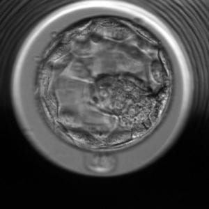 embrió embyoscope